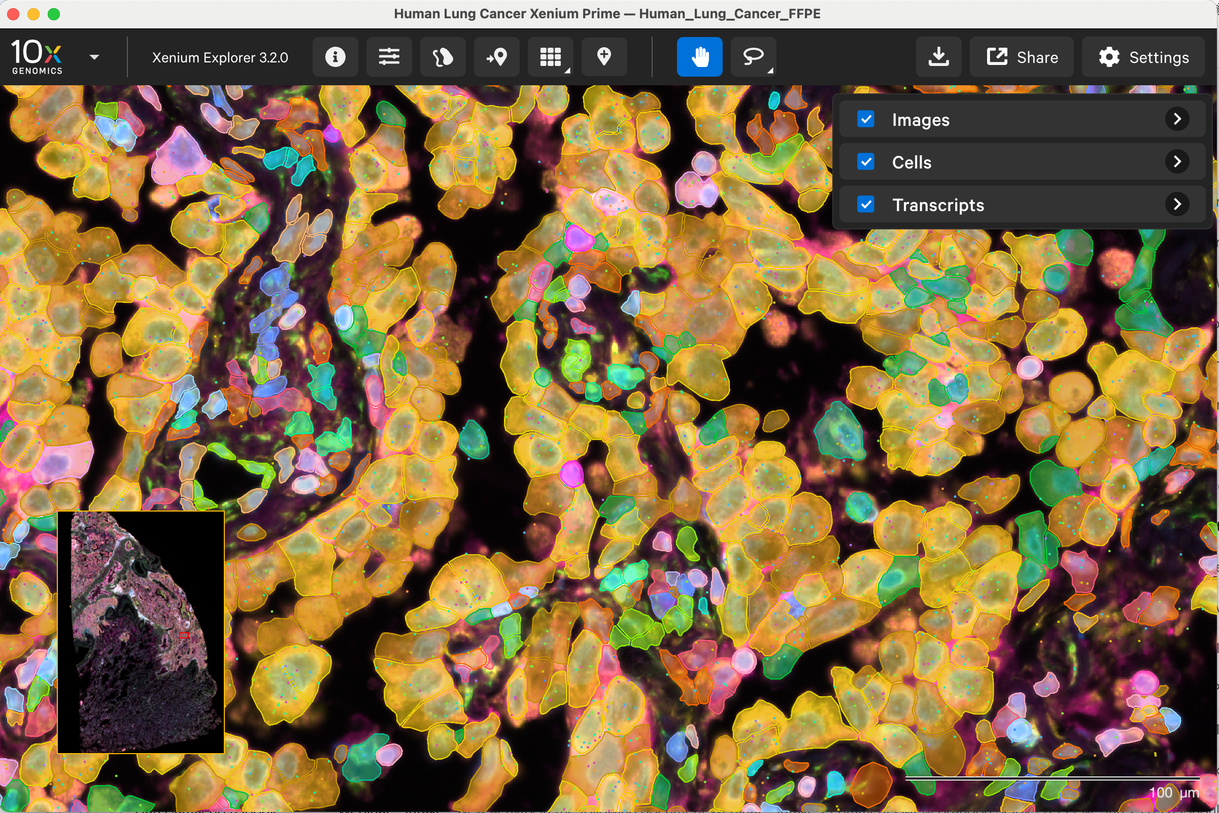 Xenium Explorer image